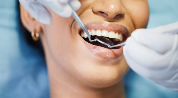 Best Emergency Root Canal Treatment in Fillmore, UT